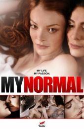 my-normal