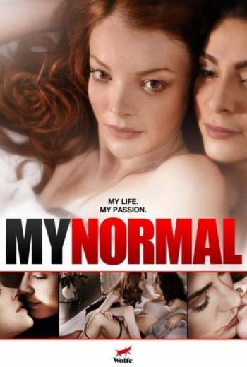 my-normal